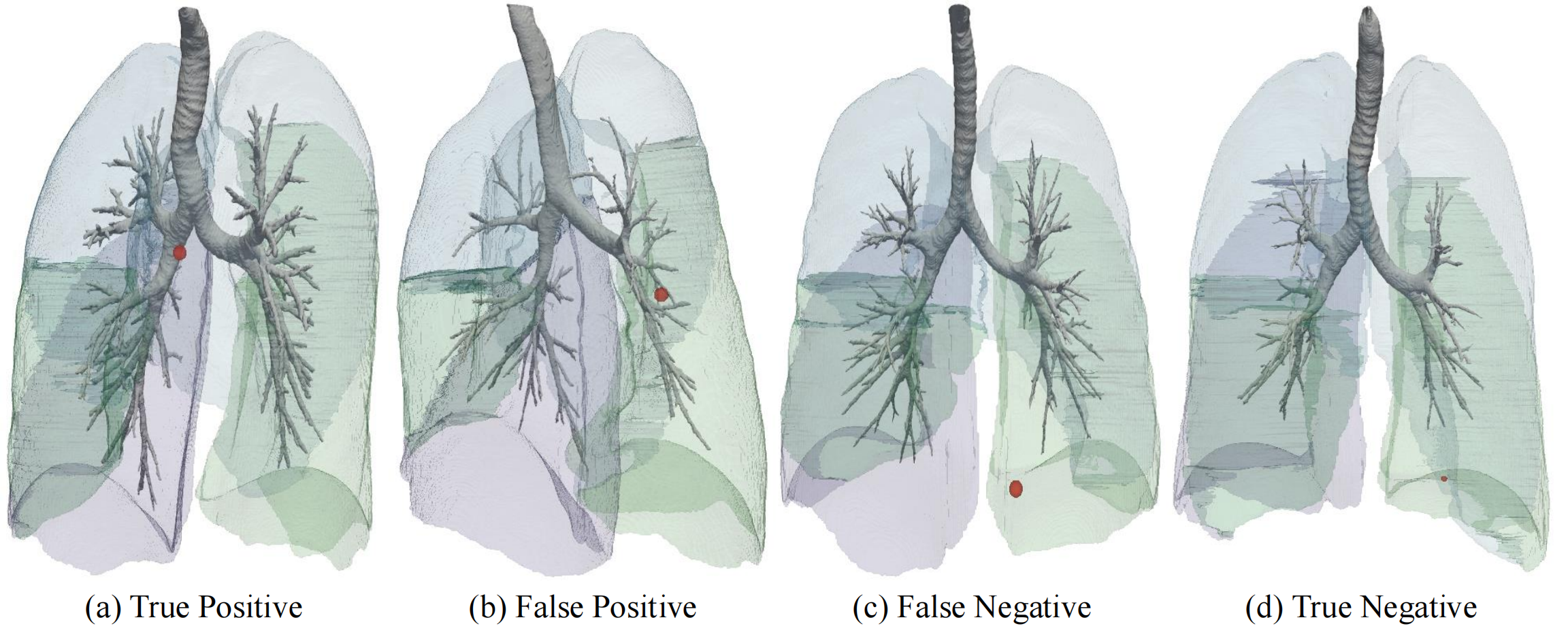 Representative TP, FP, FN, TN predictions with airway trees and lesion locations