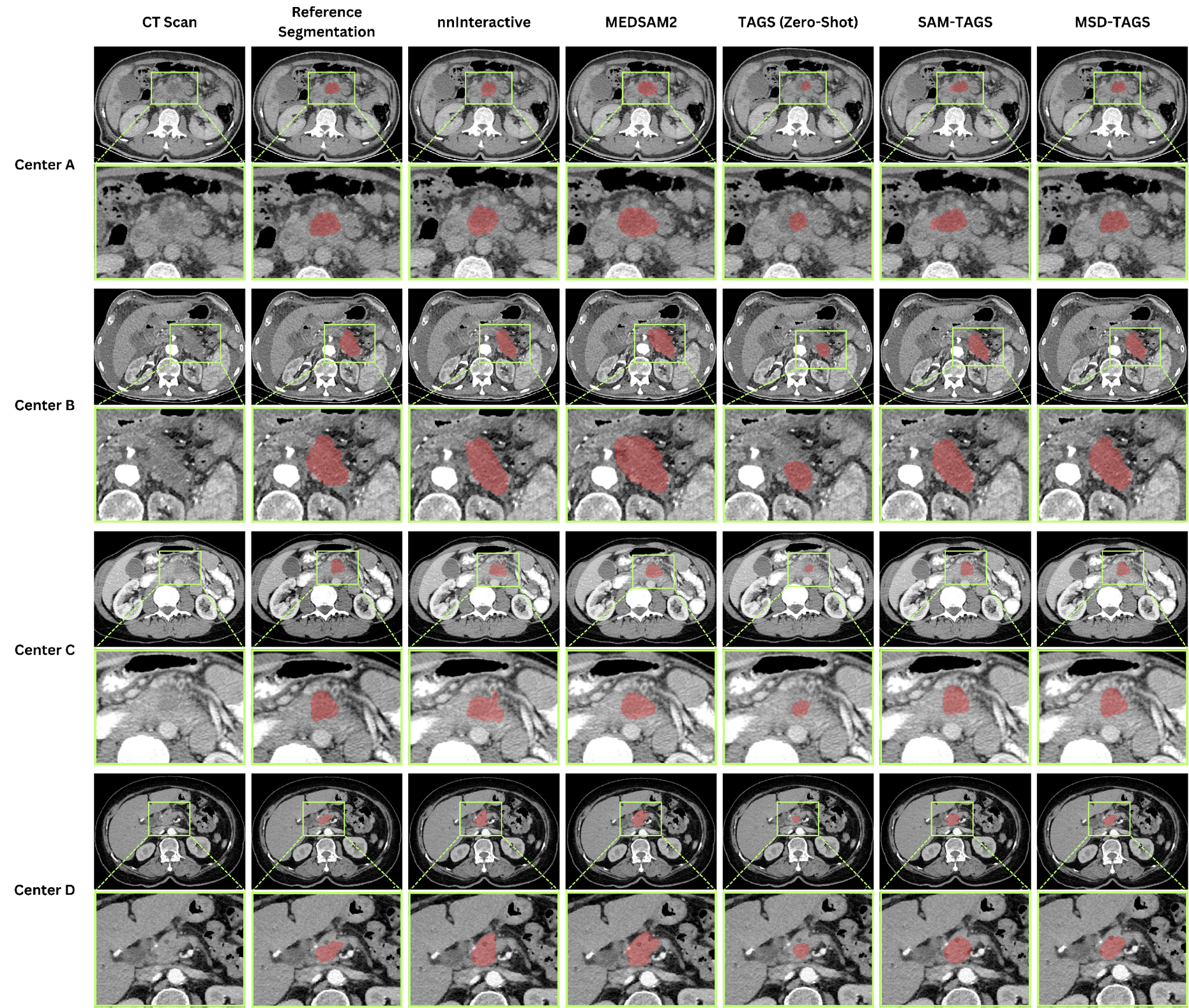 Representative segmentation outputs across centers